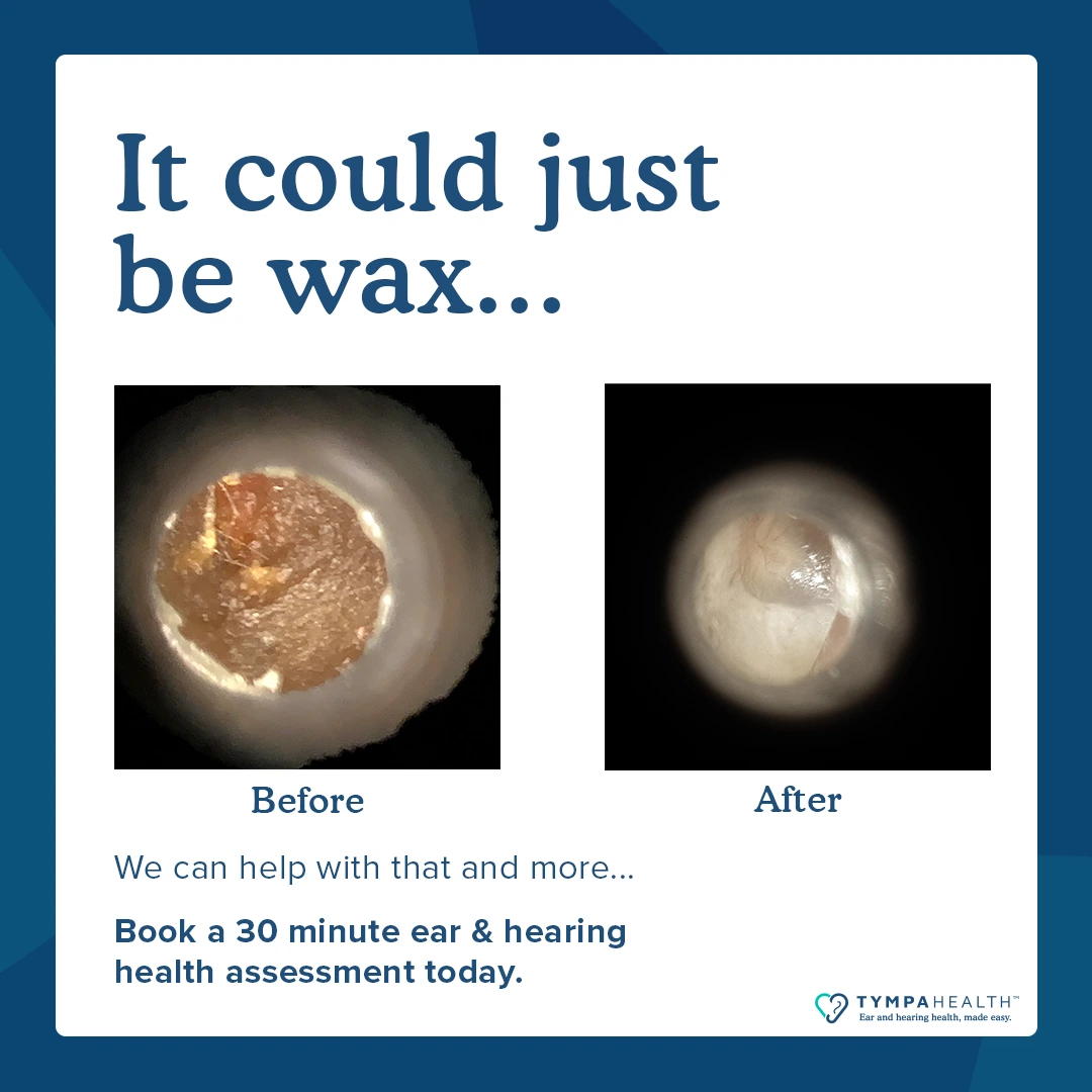 Ear Wax Removal Same Day